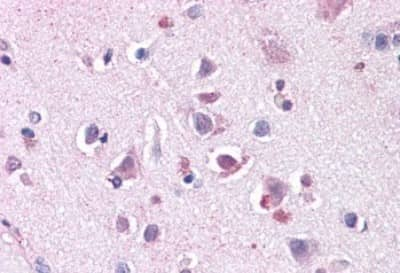 Immunohistochemistry-Paraffin: ENT1 Antibody [NBP3-14310]